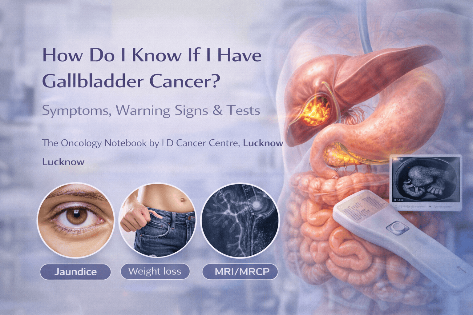 Gallbladder Cancer Symptoms, Jaundice & Tests | IDCC