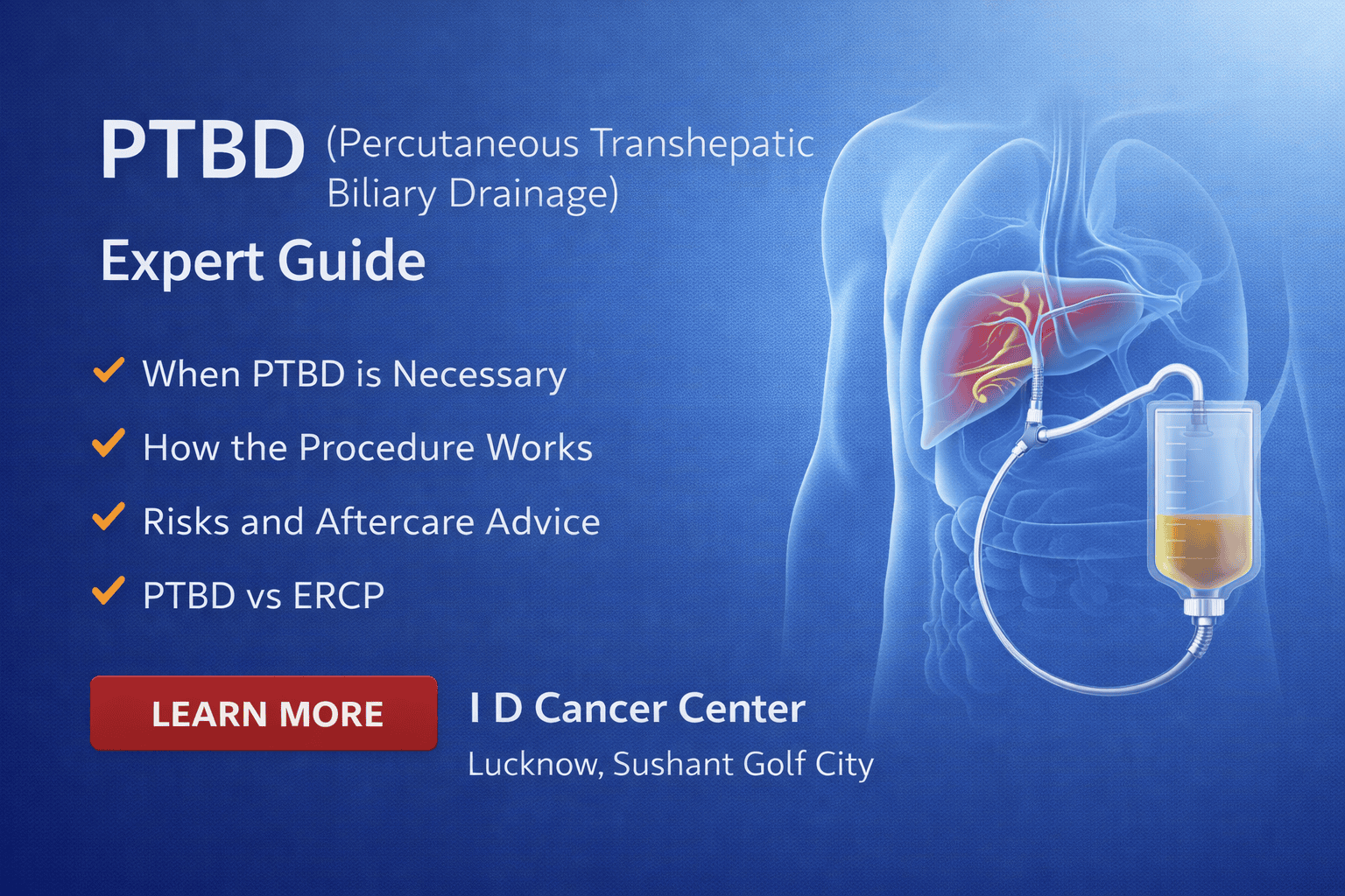 PTBD (Biliary Drainage) Explained | I D Cancer Center